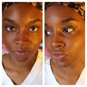 How to Get Rid of Black Spots On The Face