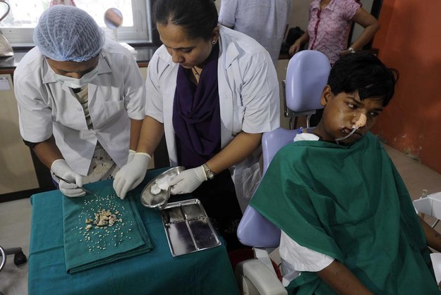Indian Doctors Remove 232 Teeth From Boy’s Mouth