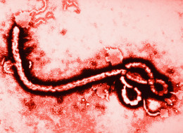Ebola Diagnosed In U.S. For The First Time: CDC