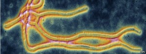 coloured_tem_of_the_ebola_virus-spl