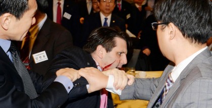 In this handout image provided by Munhwa Ilbo newspaper, U.S. Ambassador to South Korea Mark Lippert is seen right after getting attacked on March 5, 2015 in Seoul, South Korea. Ambassador Lippert was attacked with a razor blade by a man at a venue where he was going to give a lecture. The attacker who reportedly identified himself as a representative for a watchdog organization of the disputed island Dokdo/Takeshima, was arrested immediately on site. (Chung Ha-Jong/Munhwa Ilbo/Getty Images)