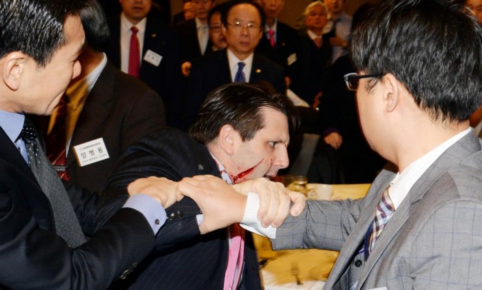 Knifed US envoy to Seoul in pain as officials investigate